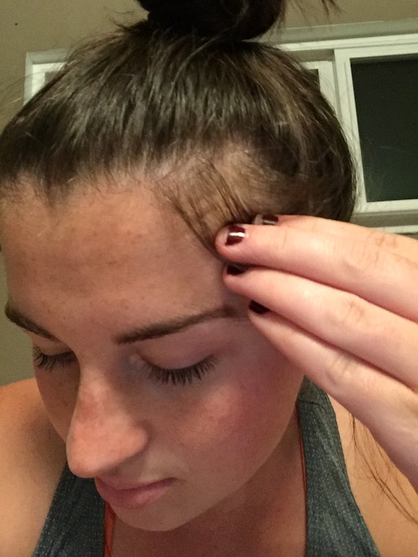 Honestly, My Postpartum Hair Loss Made Me Feel Ugly