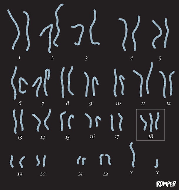 Common Chromosomal Abnormalities That Can Cause Miscarriage