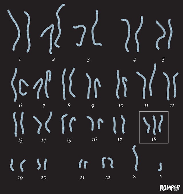 Common Chromosomal Abnormalities That Can Cause Miscarriage